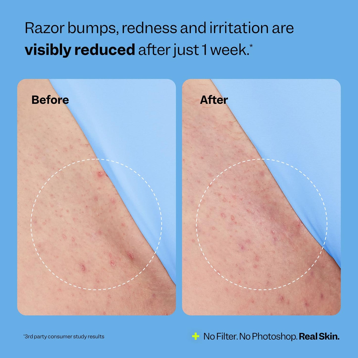 PureSkin Hydrating Roll-On
