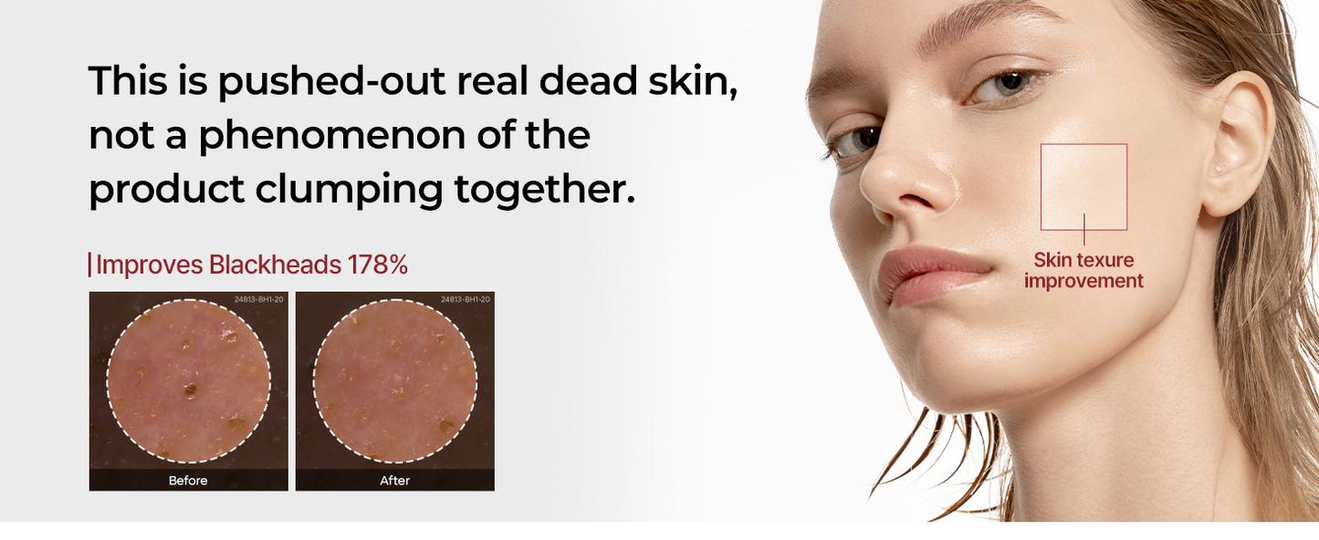 Peel Shot Glow White Rice Peeling Ampoule