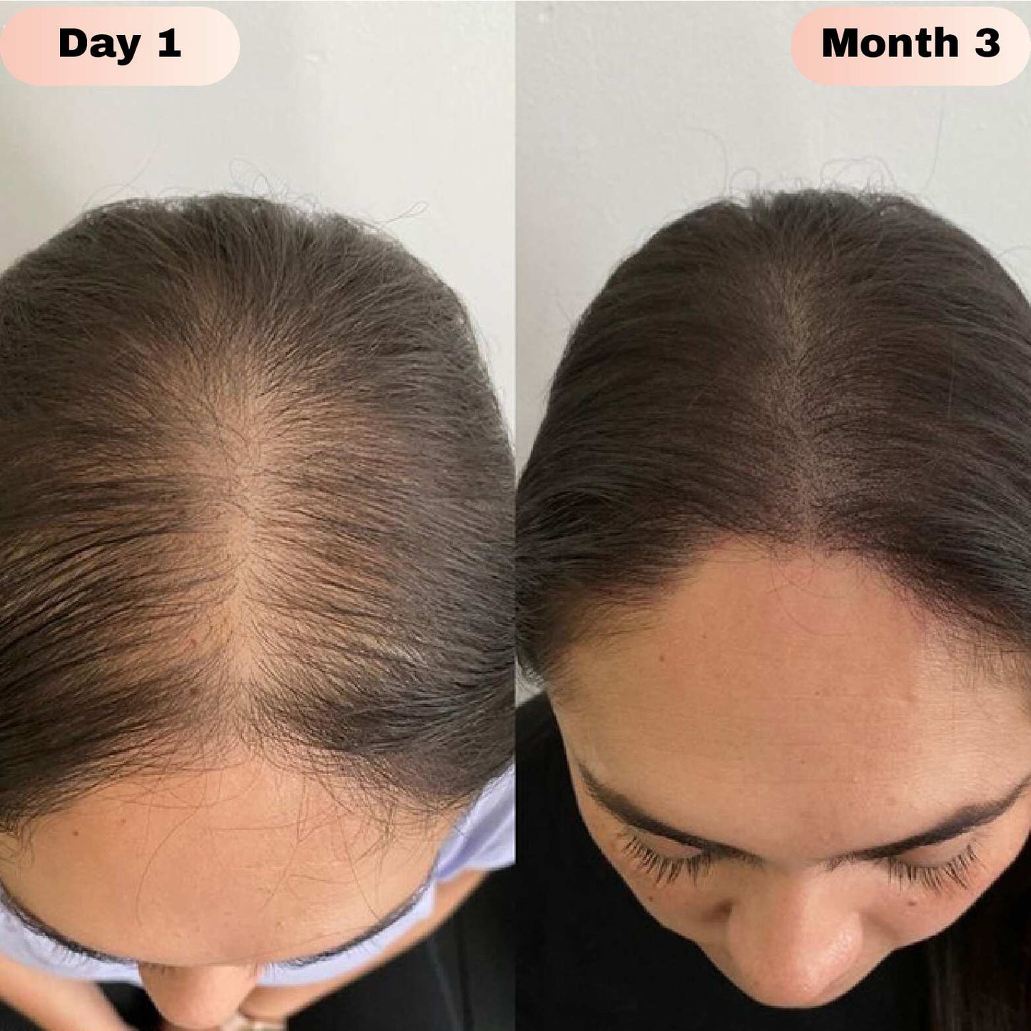 Hair Growth Serum Roll On