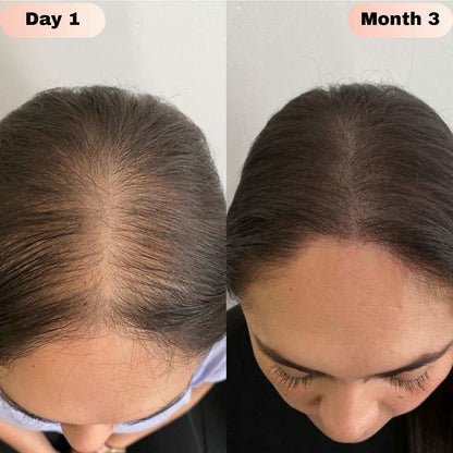 Hair BallEssence Be-Bodywise 3 Rosemary Hair Growth